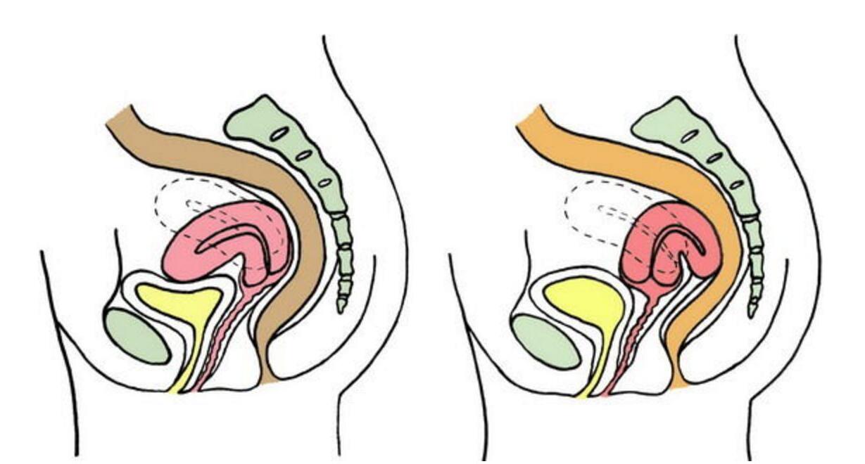 子宮后位是什么意思.jpg